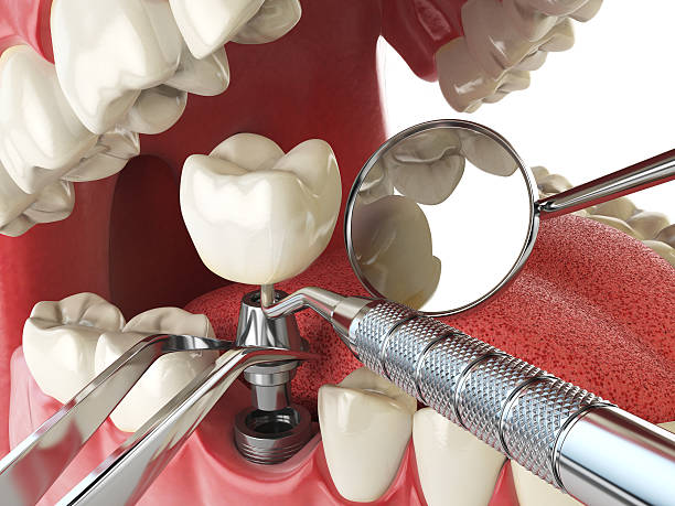 Best Knocked-Out Tooth Emergency  in Baxter, TN